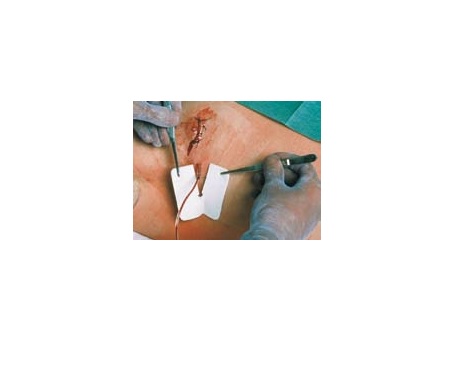 MEDICAZIONE PER TUBI DI DRENAGGIO FESSURATA METALLINE DRAIN 6X7CM FORO 4,5X11MM 50 PEZZI - Farmacia Del Monaco